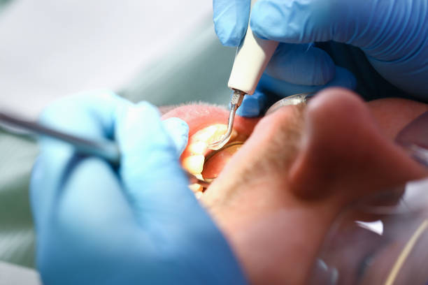 Best Emergency Root Canal Therapy in Lake In The Hls, IL