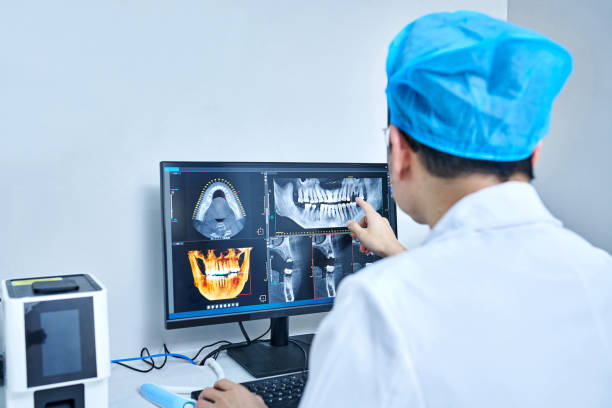 Best Emergency Wisdom Tooth Extraction in Lake In The Hls, IL
